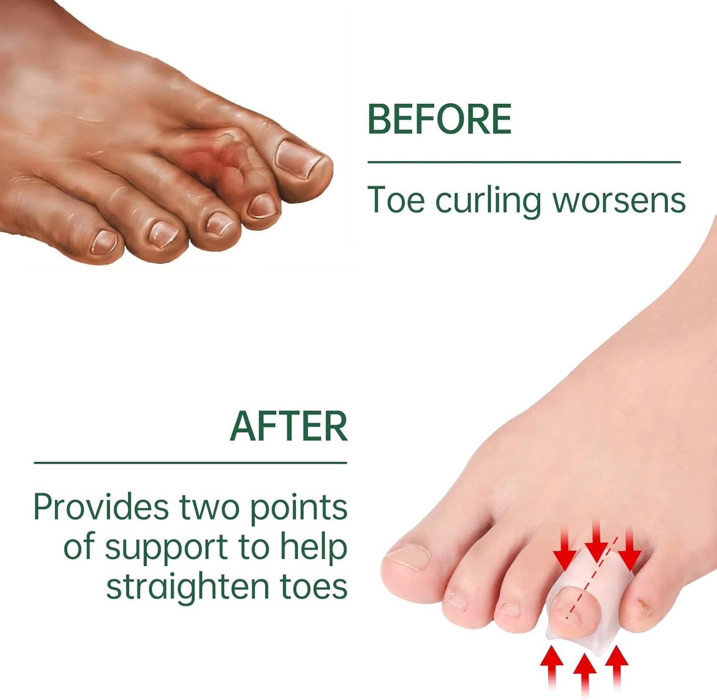 Gel Hammer Toe Corrector - Hammer Toe Straightener for Women and Men, Toe Protectors & Hammer Toe Cushion, Soft Silicone Hammer Toe Straightener Corrector, Pack of 8