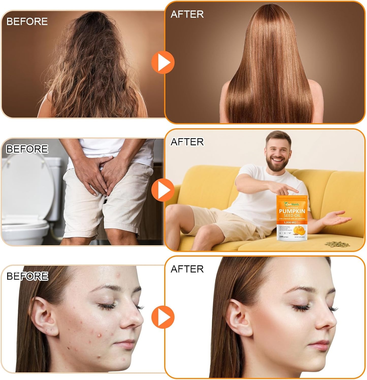 Pumpkin Seed Oil with Saw Palmetto (1000mg per Serving), Cold-Pressed Pumpkin Seed Oil for Hair Growth, Prostate Health, Urinary Tract Support, 300 Softgels Supplement of Essential Fatty Acids