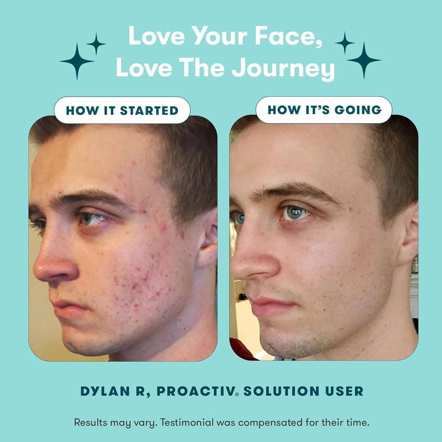 Proactiv 3 Step Acne Treatment w/ Pimple Patches - Benzoyl Peroxide Face Wash, Repairing Acne Spot Treatment for Face and Body, Exfoliating Toner - 90 Day Complete Acne Skin Care Kit + Pimple Patches