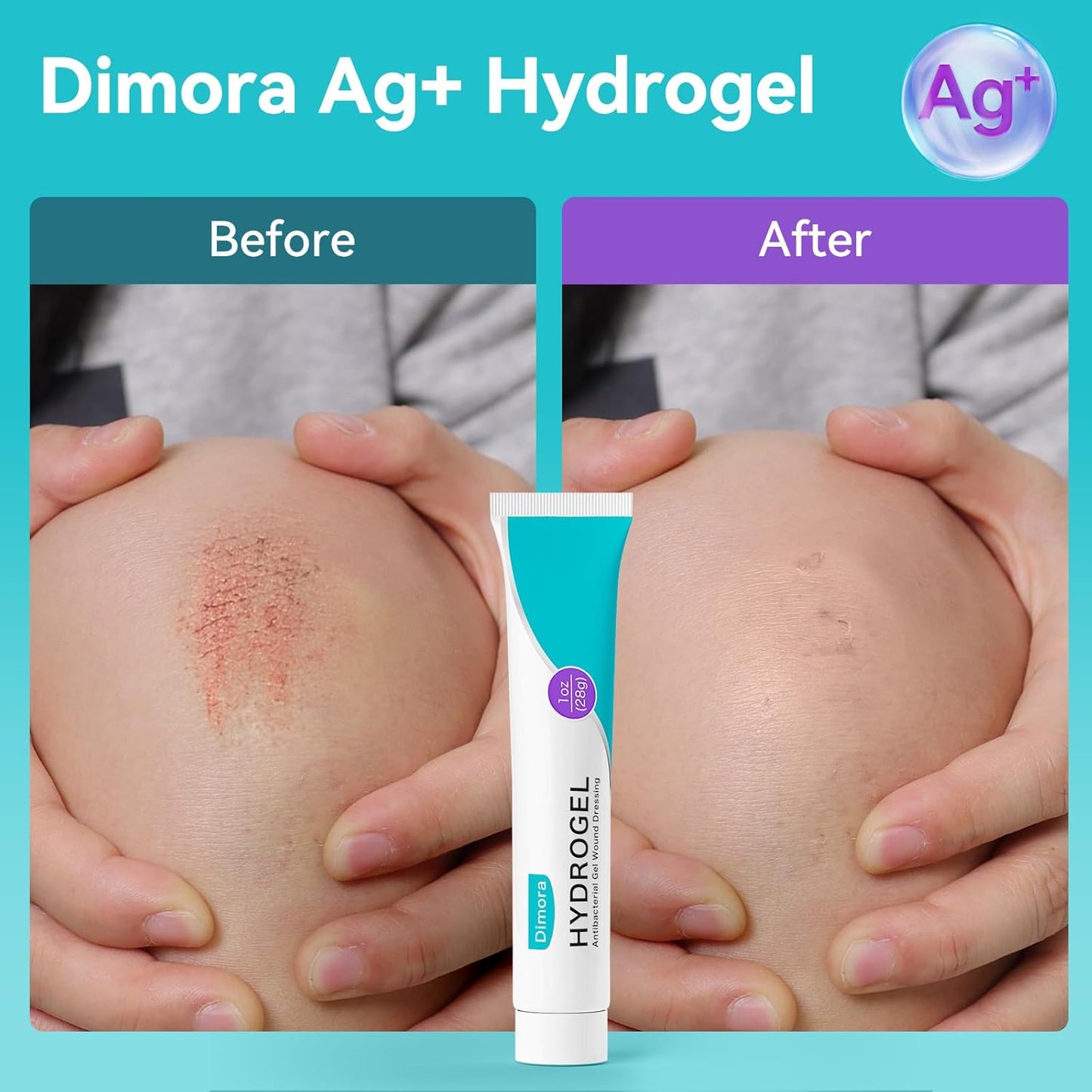 Dimora Antibacterial Gel Wound Dressing 1oz - Silver Hydrogel First Aid Ointment for Wound Healing, Antibacterial Care for Minor Cuts, Abrasions, Lacerations & Burns, Safe Non-Amorphous Formula