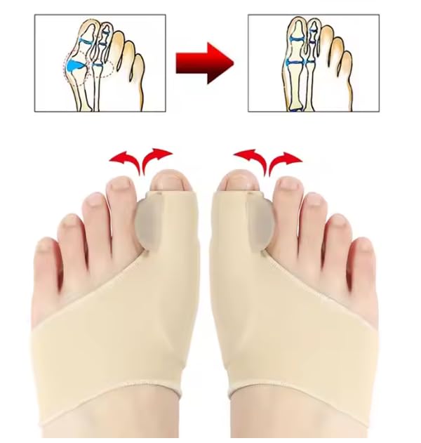 2-in-1 Foot Care Kit – Toe Correctors for Women and Men & Metatarsal Pads – Ball of Foot Cushions for Heels, Toe Separators for Alignment, Blister Prevention, Forefoot Pain Relief Bundle