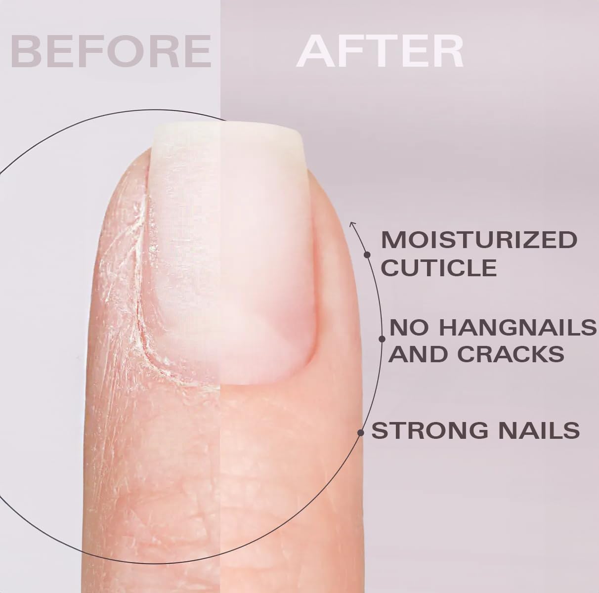 Nail Oil Cuticle Pen - Rose – Nail Strengthener & Growth Serum with Vitamin A, D, E, B5, Grapeseed & Natural Oils – Repair for Brittle, Peeling, Thin Nails – Twist Brush Pen