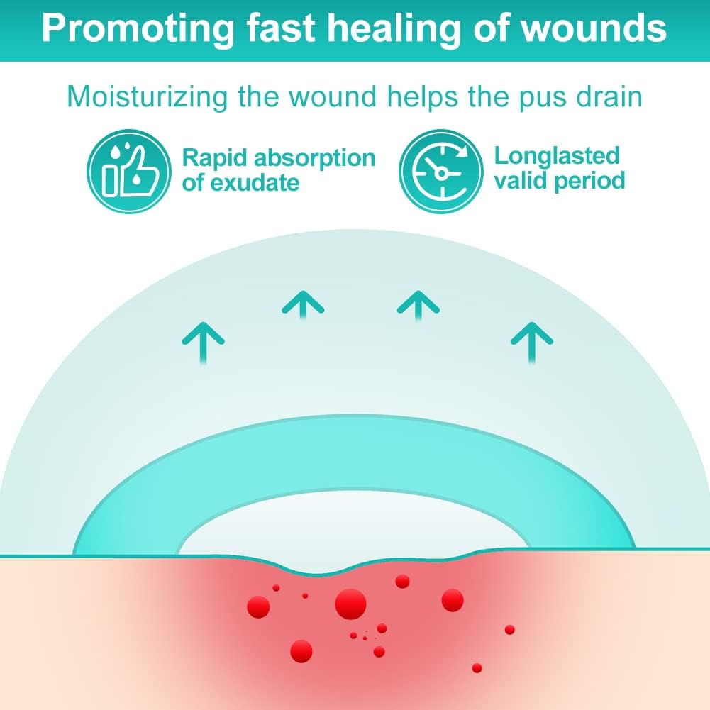 Dimora Hydrocolloid Dressing 4" x 4" for Wound Care, 10 Pcs Large Patch Bandages with Self-Adhesive for Bedsore, Burn, Blister, Acne Care, Super Absorbent for Fast Healing