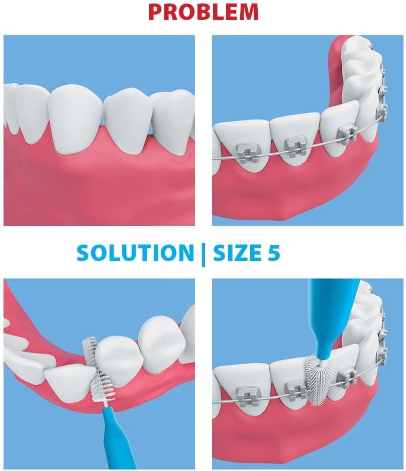 Piksters Interdental Brushes, Size 5, 100 Count (10 x 10 Packs), Interdental Tooth Brush for Large Gaps, Gum Soft Bristles for Plaque Removal, Safe for Braces (100 pk)