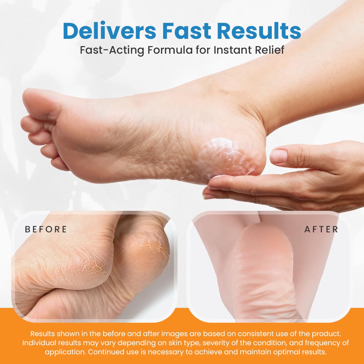 Revitaderm 4D Urea Cream 40% for Feet, Intensive Moisturizing Foot Cream for Dry, Rough, Callused Skin, Includes Free Pumice Stone and Exfoliating Brush, Fast-Absorbing, Fragrance-Free, 4oz, 1 Pack