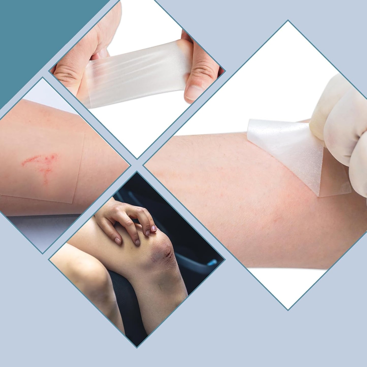 Hydrocolloid Roll for Wound Care - Self-Adhesive Hydrocolloid Bandage 2" x 16.4ft (5cm x 5m), Cut-to-Size, Waterproof, Ultra Absorbent for Blisters, Burns, Acne & Bed Sores