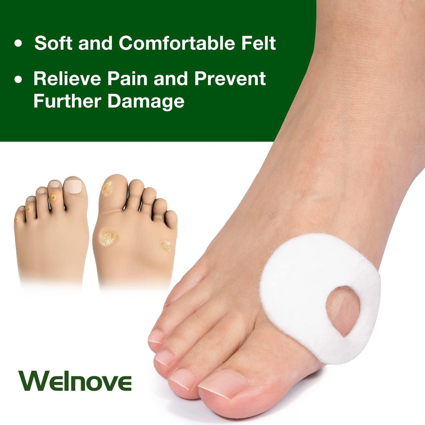 Welnove 84pcs Callus Pad with Water-Resistant Self-Stick Adhesive, Protects Foot, Heel and Toes from Rubbing and Friction,Oval Shape Design,Reduce Pressure and Friction from Shoes Rubbing-White