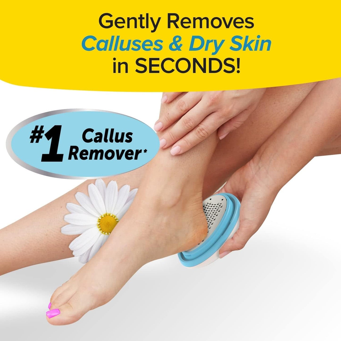 PedEgg Classic Callus Remover, As Seen On TV, New Look, Safely & Painlessly Remove Tough Calluses Dry Skin to Reveal Smooth Soft Feet, 135 Precision Micro-Blades, Traps Shavings