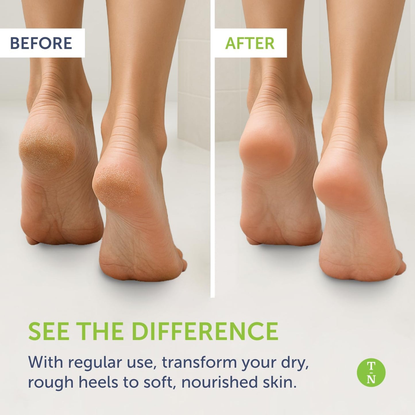 Truremedy Naturals Remedy Balm with Tea Tree Oil, 2 oz - Soothing Moisturizer for Rough Areas - Nourishing Foot and Body Balm with Tea Tree, Lavender, and Eucalyptus