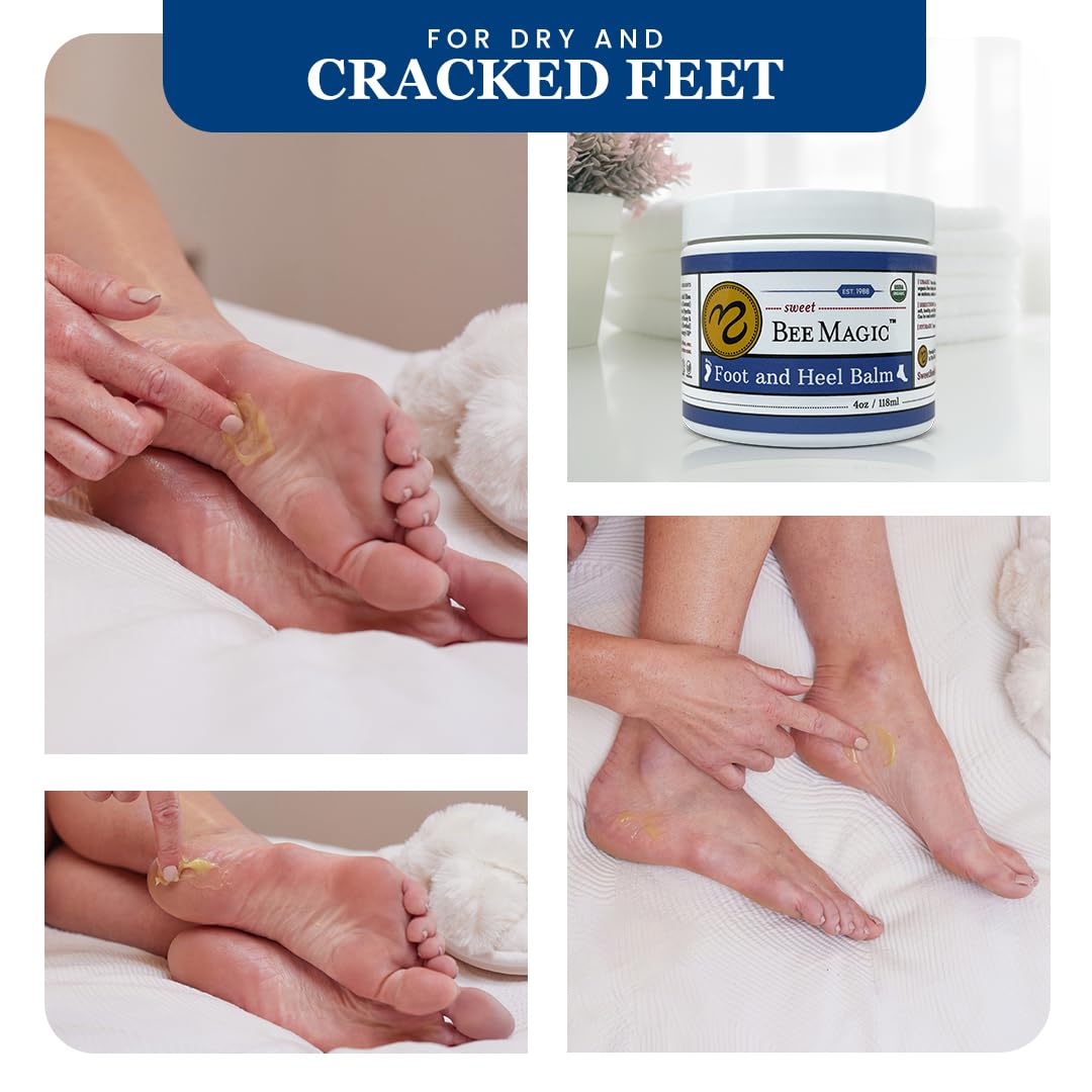 Sweet Bee Naturals All-Natural Organic Foot and Heel Balm – Deep Moisturizing for Dry, Cracked Feet, Heel Care & Callus Softening – Smooth & Nourish Rough Skin – Made with Care – 2 Jars (8 OZ)