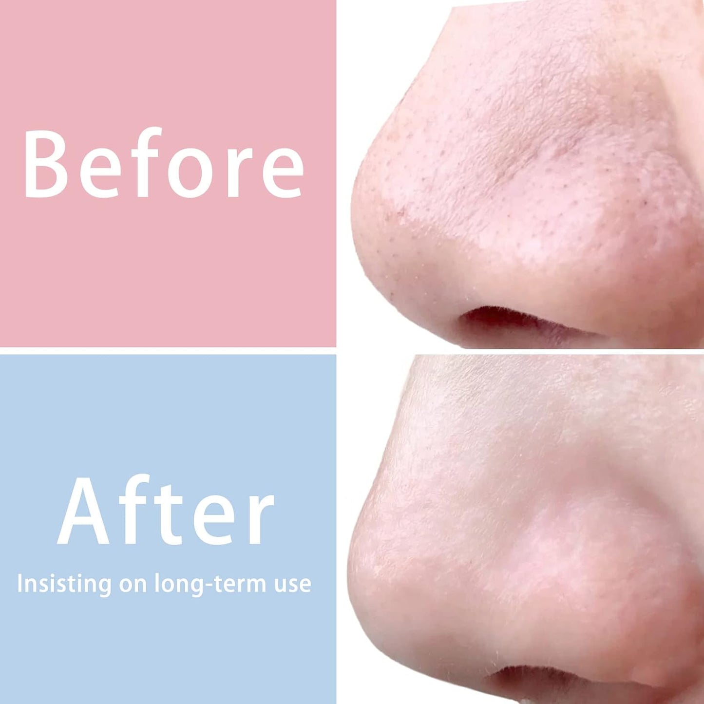 MIG4U 3 PCS Exfoliating Facial Scrubber Mitt, Face Cleanser Wash Mittens Exfoliator for Men & Women Dead Skin Cleaning Gloves