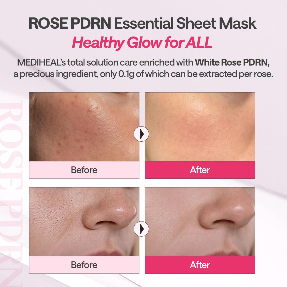 Mediheal Rose PDRN Essential Sheet Mask 4 pcs. 99% Pure White Rose PDRN & Hyaluronic Acid for hydrating, firming, and enhancing moisture barrier, skin firmness, and glow. Vegan formula