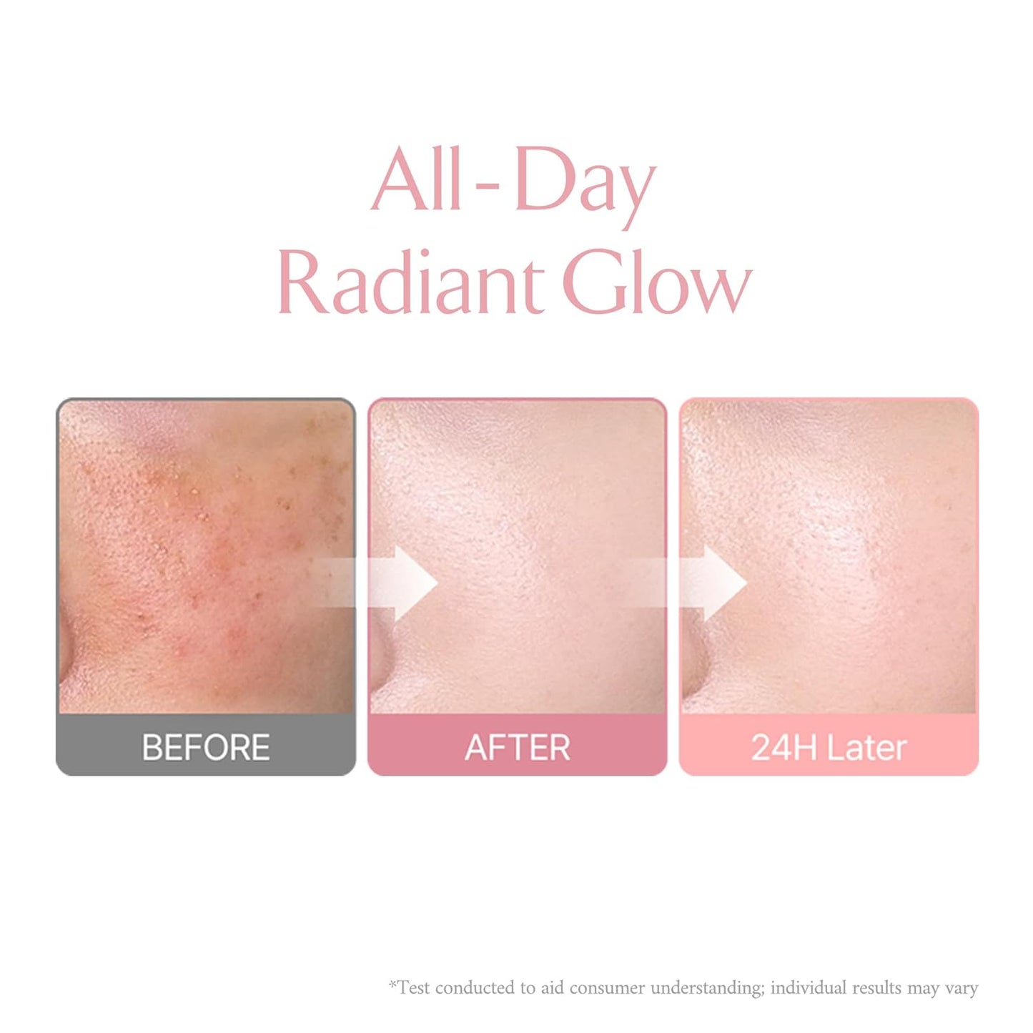 LA MUSE Korean Glow Cushion Foundation with PDRN(Refill) | Shade No.20 Pure Ivory for Fair Skin | 65% Hyaluronic Acid Hydration | Natural Radiant, Lightweight Coverage | Light-Medium Buildable Finish