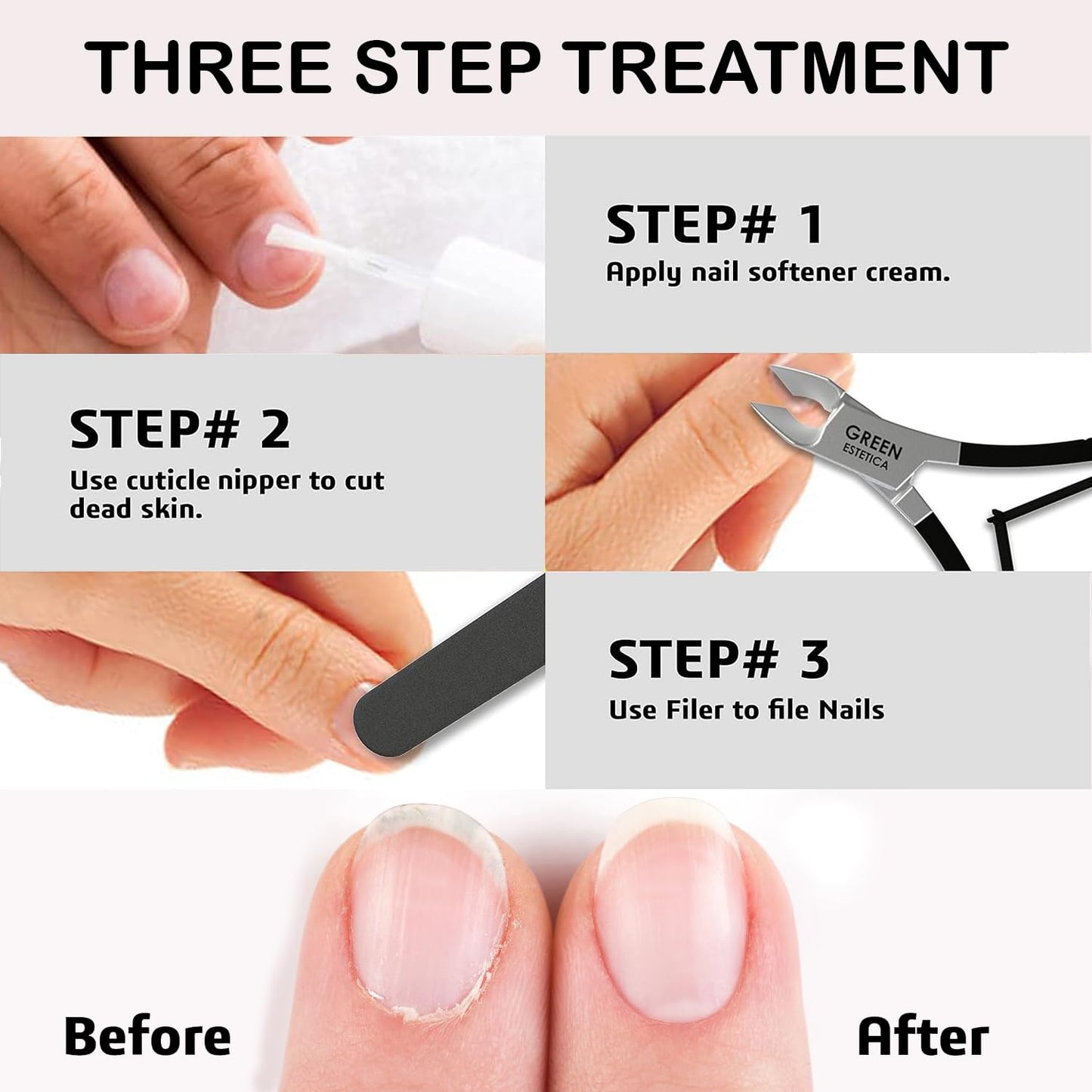Professional Cuticle Trimmer Nail Cuticle Cutter Stainless Steel Cuticle Nippers with Sharp Blades of Cuticle Remover Clippers Manicure Tools Double Spring for Nail Care Pedicure Nail Tools (Black)