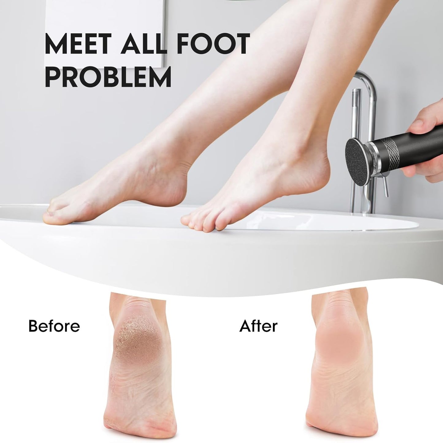 Upgraded Electric Foot Callus Remover, Adjustable Speed Feet File, Pedicure Tools with 60 Sandpaper Discs for Man Women Dead Skin, Hard Cracked Skin, Dry Skin, Ideal Gift - Black