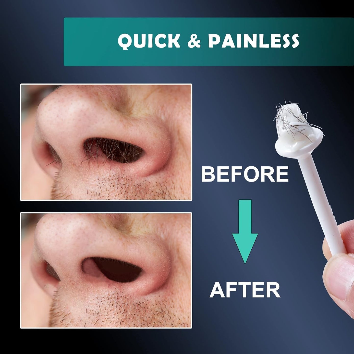 300g Wax Nose Wax Kit, Nose Hair Wax with 10 Waxing Sticks, Quick & Painless Nose Hair Waxing Kit for Men and Women Used at Least 50 Times Usage