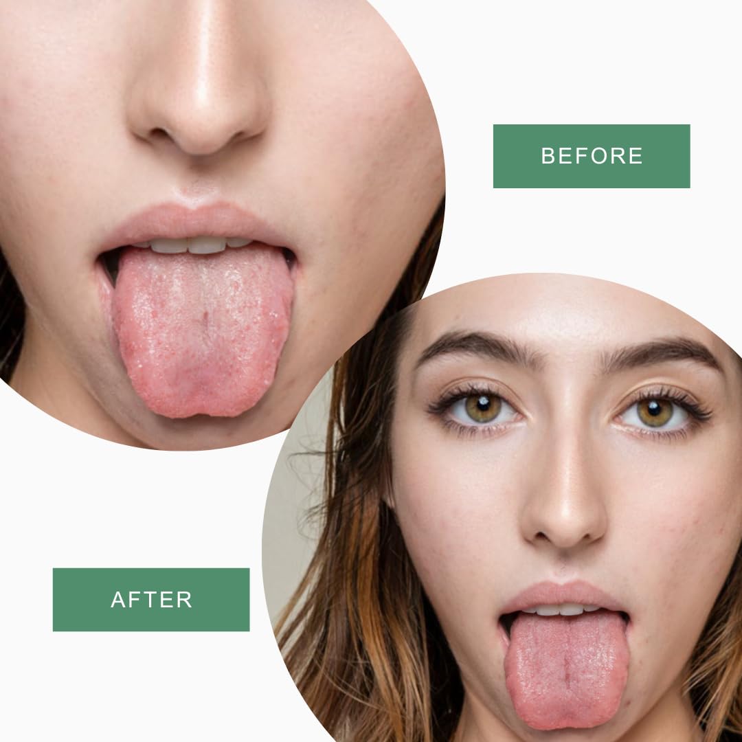 Stainless Steel Tongue Scraper for Adults with Travel Case (2 Pack) – Stainless Steel Cleaner for Daily Hygiene, Reduce Bad Breath – Oral Care Travel Essentials, Metal Tongue Scraper