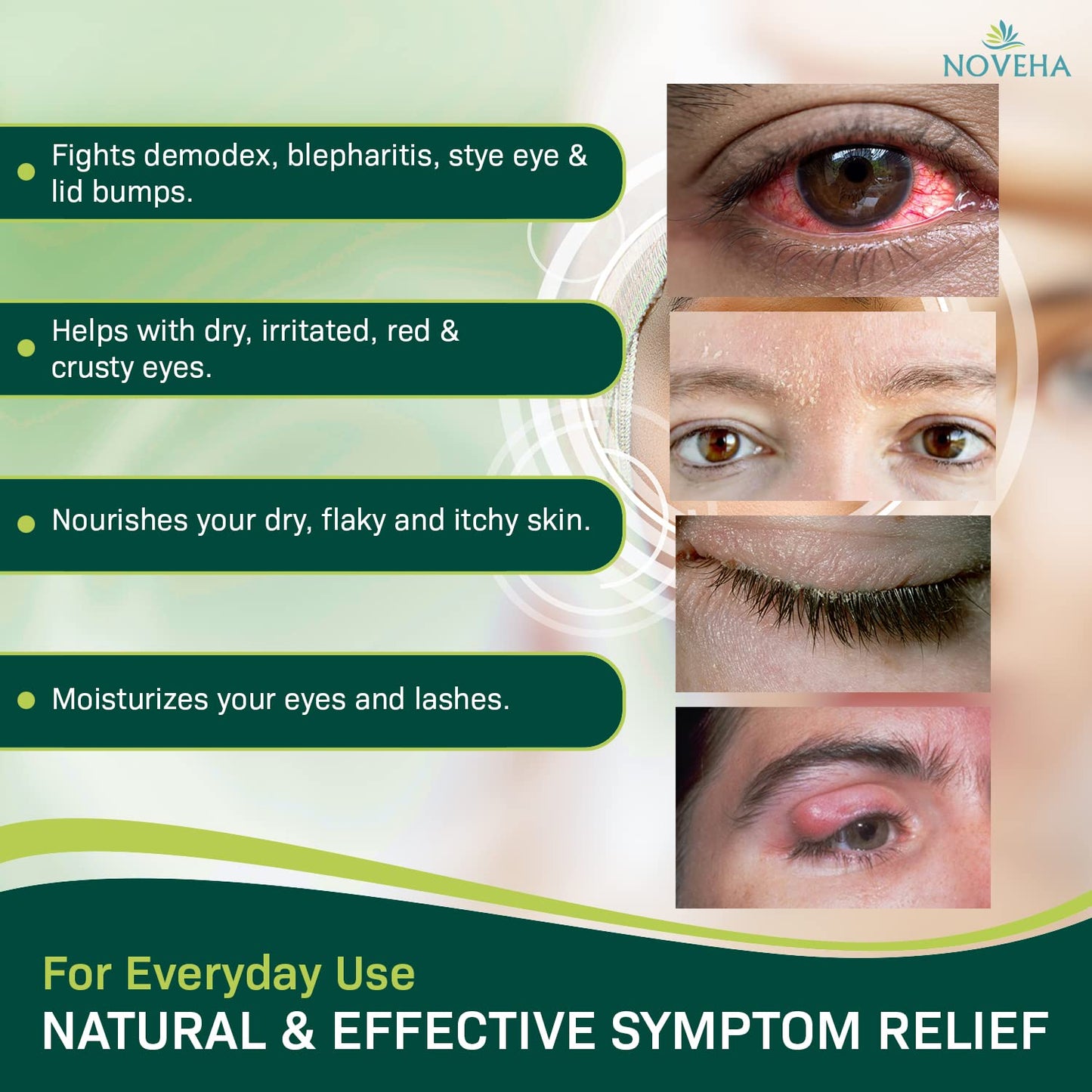 Demodex Eyelid Cleanser Foam | Extra Strength Tea Tree Oil Formula | Daily Face Wash For Eyelash, Demodex, MGD, Stye Eyes, Eye Irritations & Skin Dryness, 3.38 fl oz (100ml)