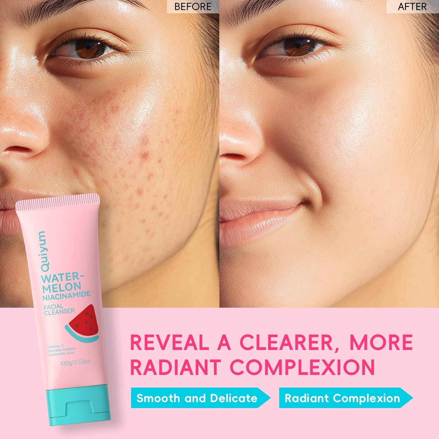 Foaming Face Wash, Watermelon Extracts, Niacinamide, Vitamin C, Hyaluronic Acid, Centella Asiatica, Exfoliating, Pore Minimizer, Hydrate, Glow, 3.53 Oz