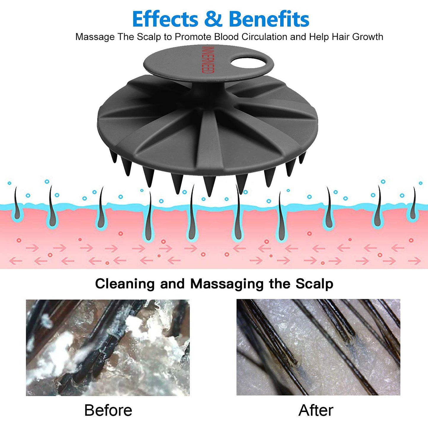 INNERNEED Scalp Care Massager Shampoo Brush, Wet & Dry Manual Head Scrubber Hair Washing, Soft Silicone Bristles, for Hair Growth, Dandruff Removal, Comfortable for All Hair Types (Black)