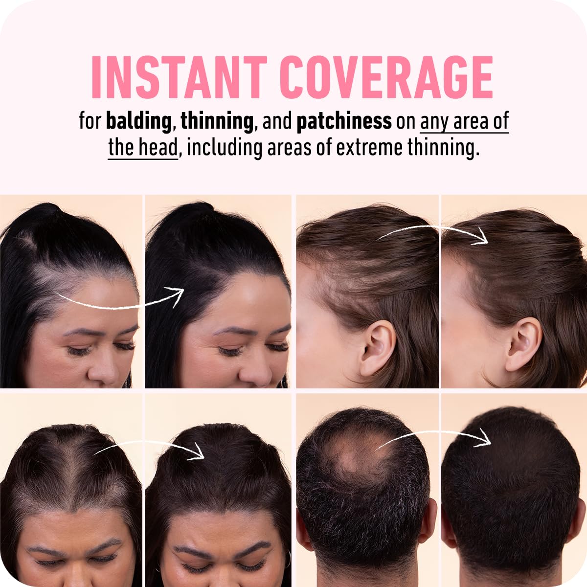 BOLDIFY Hairline Powder - Root Touch Up Hair Color for Gray Coverage - Bald Spot Concealing Hair Powder for Women & Men - 48-Hour Stain-Proof - Black