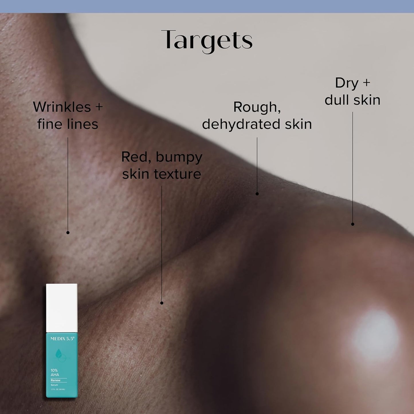 MEDIX 10% Glycolic Acid + Lactic Acid Leave-On Exfoliating Body Gel | AHA Exfoliant Body & Face Serum Refines + Softens Dry Dead Skin, Bumpy Skin, Uneven Skin Tone, KP Bumps, & Wrinkles, 1.7oz, 2PC