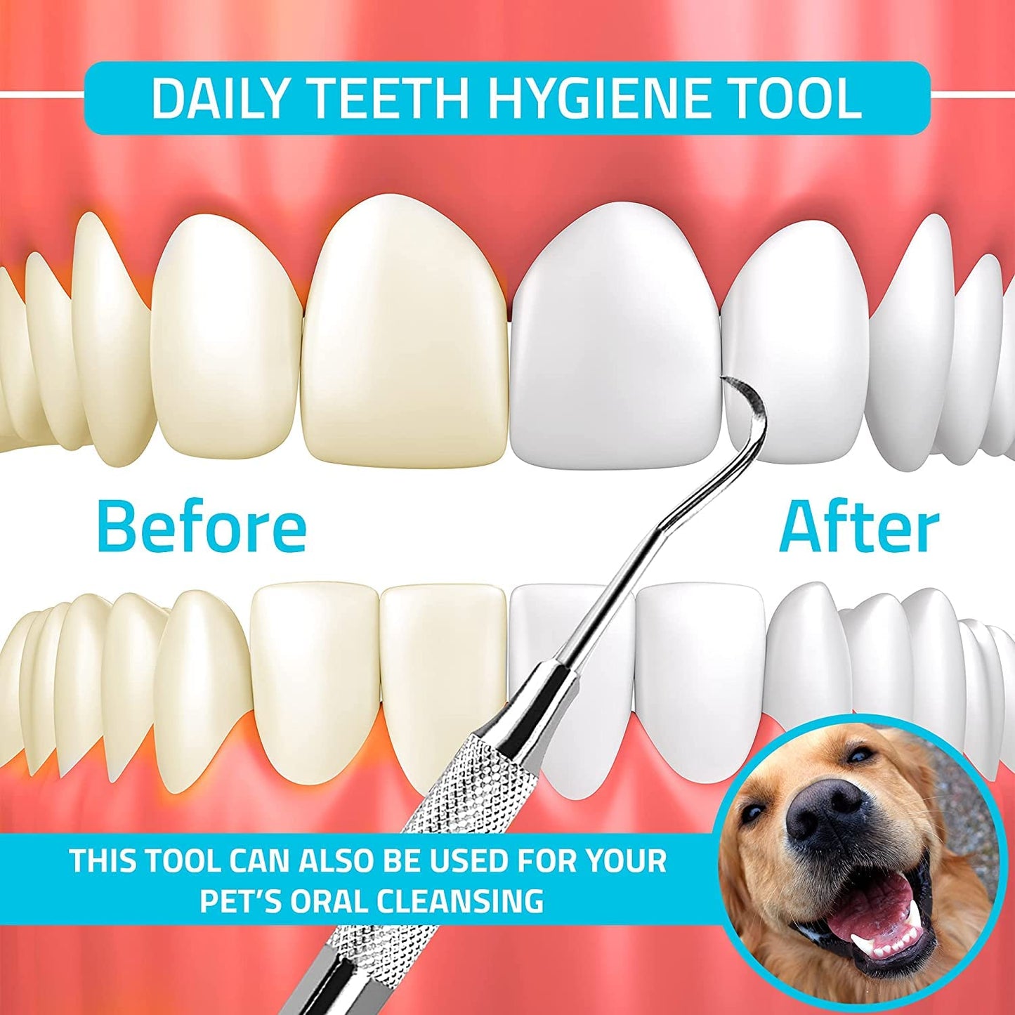 Utopia Care Professional Dental Tartar Scraper Tool, Dental Pick, 6.5 Inch Double Ended Tartar Remover for Teeth, Plaque Remover, Tooth Scraper, Silver, Pack of 2