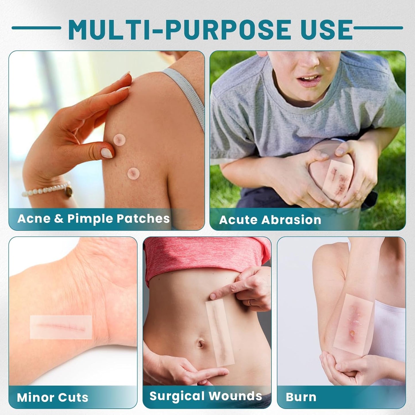 WUYUAN Hydrocolloid Roll for Wound Care, 4in*6.6ft Hydrocolloid Bandages with Self-Adhesive, Extra Large Hydrocolloid Patch Bandages Cut-to-Size, Ultra Absorbent, Waterproof