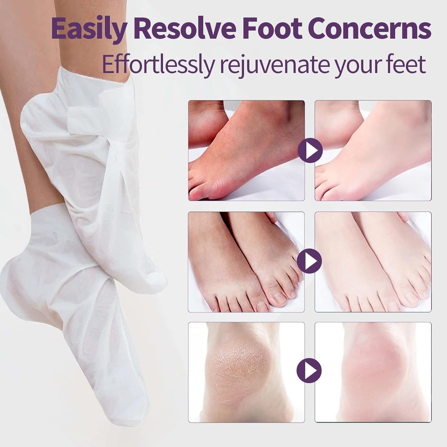 Moisturizing Foot Mask 5 Pack,Hydrating Foot Masks for Dry Cracked Feet,Moisturizing Socks Dry Skin Moisturizer for Soft and Smooth Touch Feet,Foot Care Spa Gifts for Women Men Stocking Stuffers