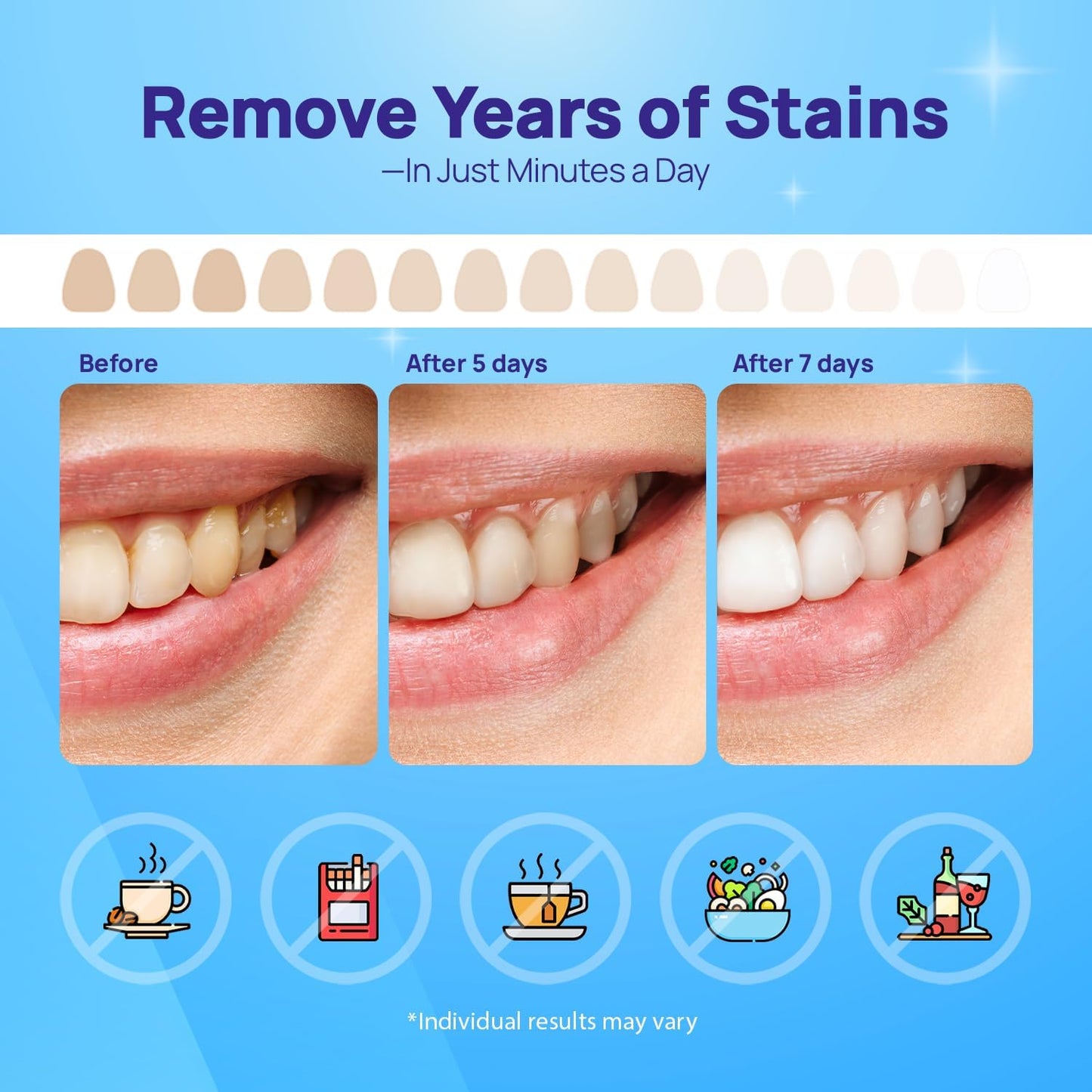 Whitebite Pro Upgraded Teeth Whitening Strips 28 Strips (14 Treatments) | Enamel-Safe | Deep Stains Removal | Non-Slip Design | Whitening Without Any Harm | Mint