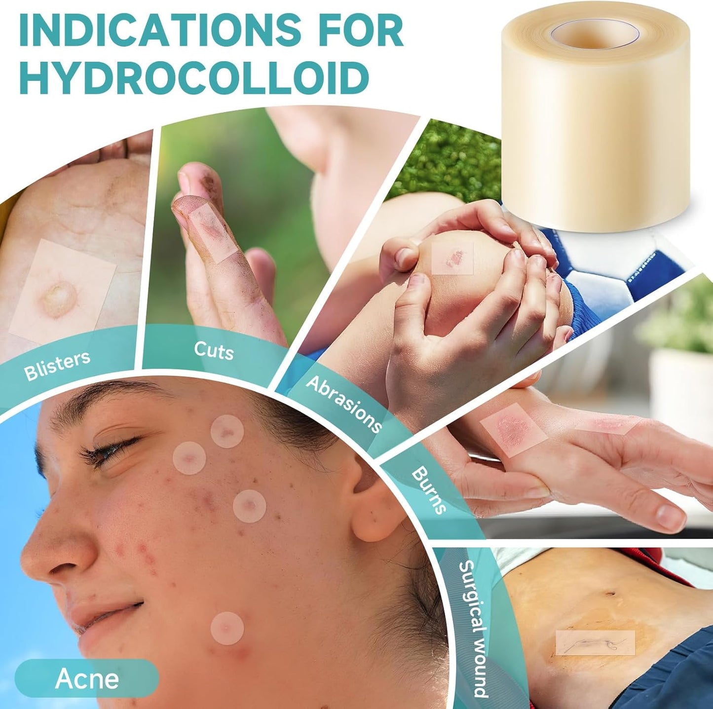 HONKID Hydrocolloid Roll for Wound Care, 2in*16ft Extra Large Cuttable Hydrocolloid Patch Bandages, Self-Adhesive, Super Absorbent, Flexible & Waterproof, Sterile in Aluminum Foil Pouch