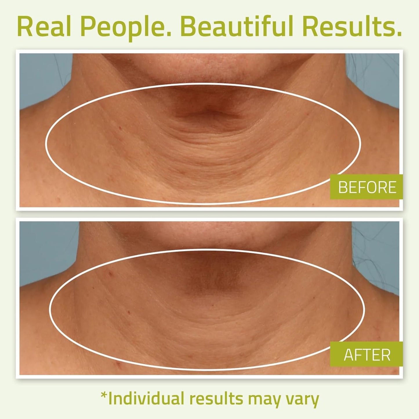 YEOUTH Neck Cream with Vitamin C, Skin Firming Moisturizer for Women and Men, Face and Neck Firming Cream Targets Double Chin, Décolletage, and Chest 4oz