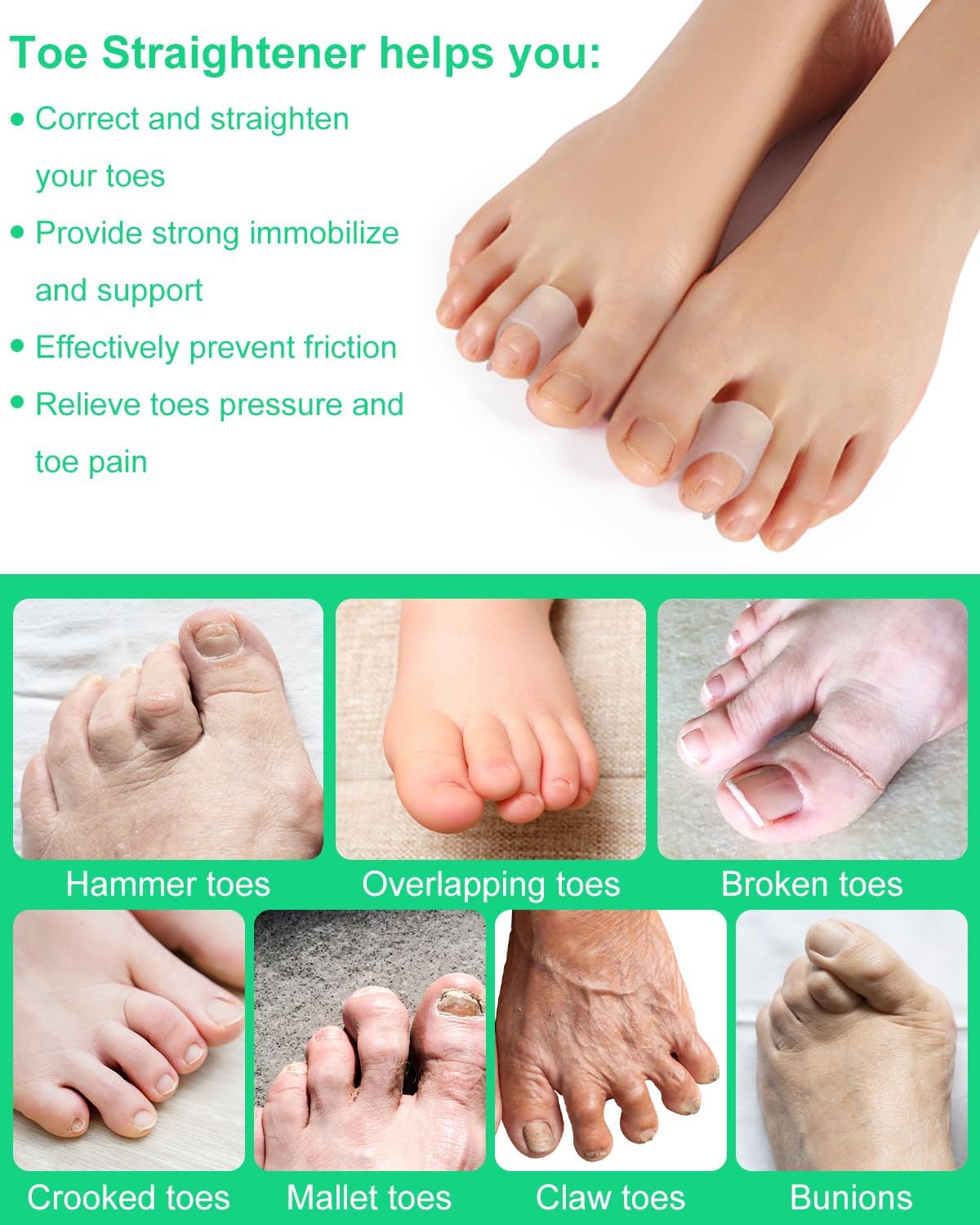 10Pcs Hammer Toe Corrector Straighteners for Women and Men Curled Toes, Crooked, Claw, Hammertoe, Soft Gel Toe Splints for Straightening, Clear Bunion Spacer Separators (Large)