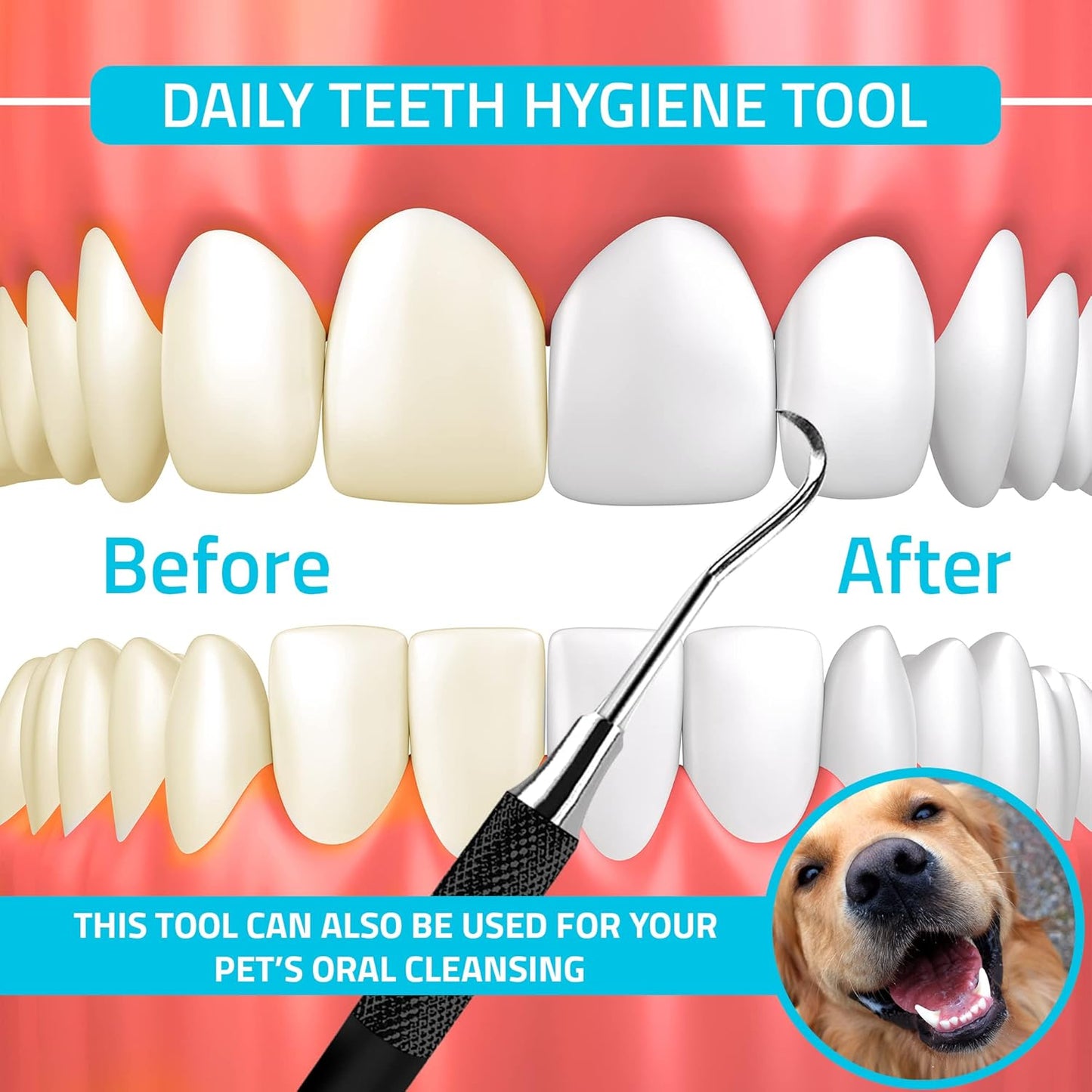 Utopia Care Professional Dental Tartar Scraper Tool, Dental Pick, 6.5 Inch Double Ended Tartar Remover for Teeth, Plaque Remover, Tooth Scraper, Black, 1 Piece