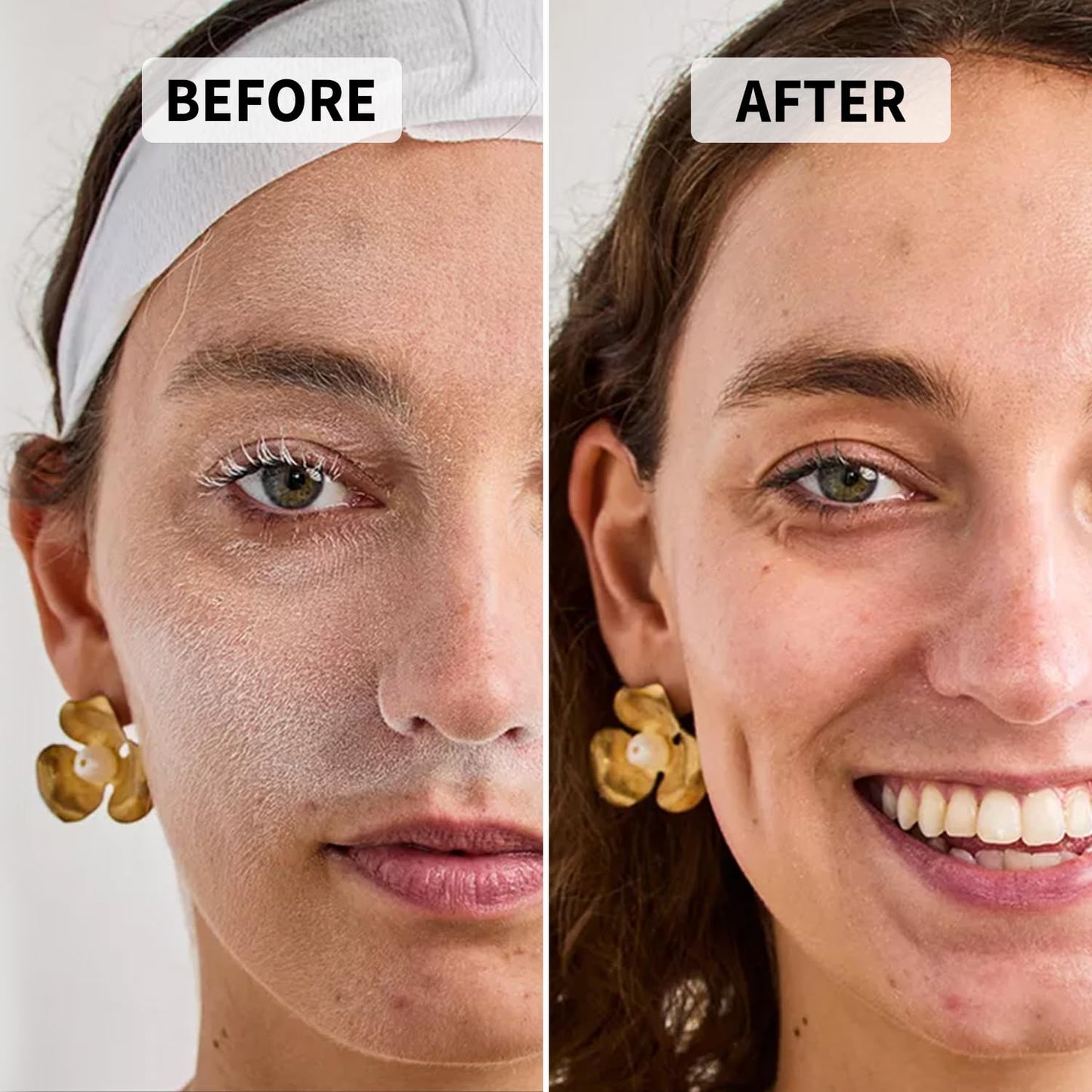 Precision Dermaplane Razor, Face Razors for Women and Men, Eyebrow Razor, Dermaplaning Tool, Peach Fuzz Remover, Skin-friendly Microblades with Protective Cap