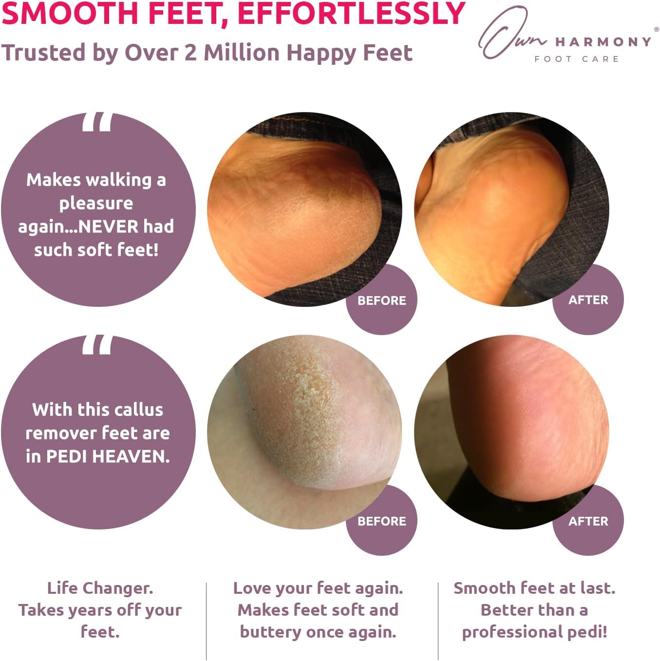 Electric Callus Remover for Feet: Professional Foot Care for Women by Own Harmony - Rechargeable Pedicure Tools - Electronic Foot File Pedi Sander - Best for Hard, Dry, Dead, Cracked Skin (3 Rollers)