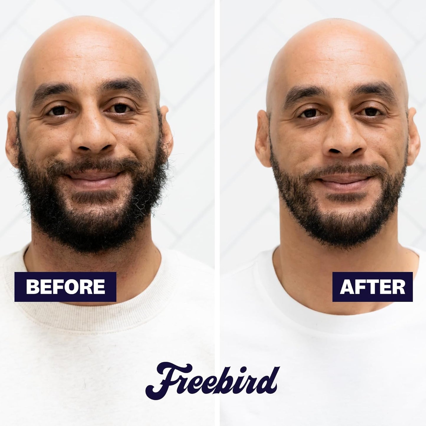 Freebird BeardSeries Trimmer for Men - Ultra Sharp Beard Trimmer with Precision Dial, Stainless Steel Blades, 40 Length Settings, Cordless & Rechargeable, for Beard, Hair, Body, & Intimate Grooming