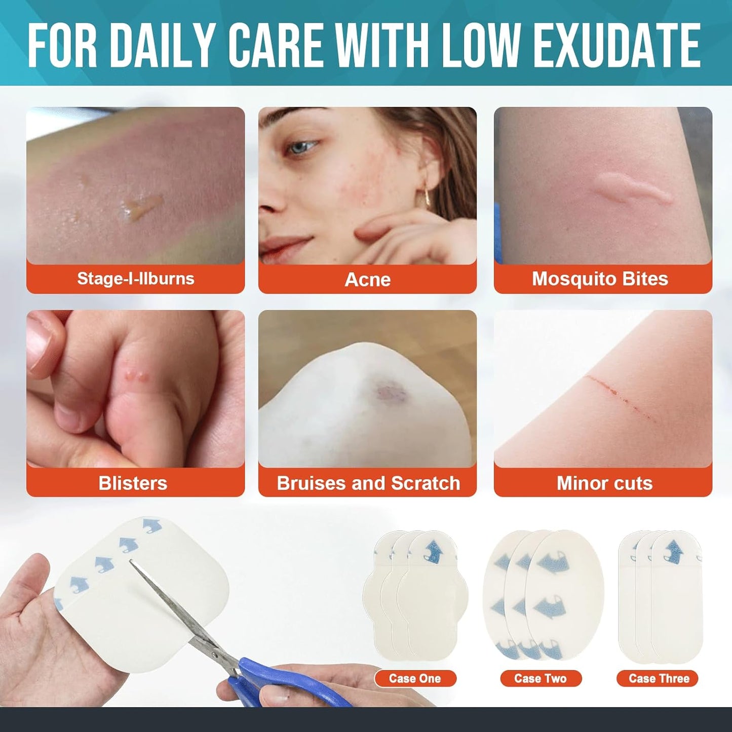 10 Pack Hydrocolloid Wound Dressing, 4" x 4" Ultra Thin Hydrocolloid Bandages with Self-Adhesive, Waterproof Hydrocolloid Patch for Bed Sore, Mild Burn, Blister, Acne Care