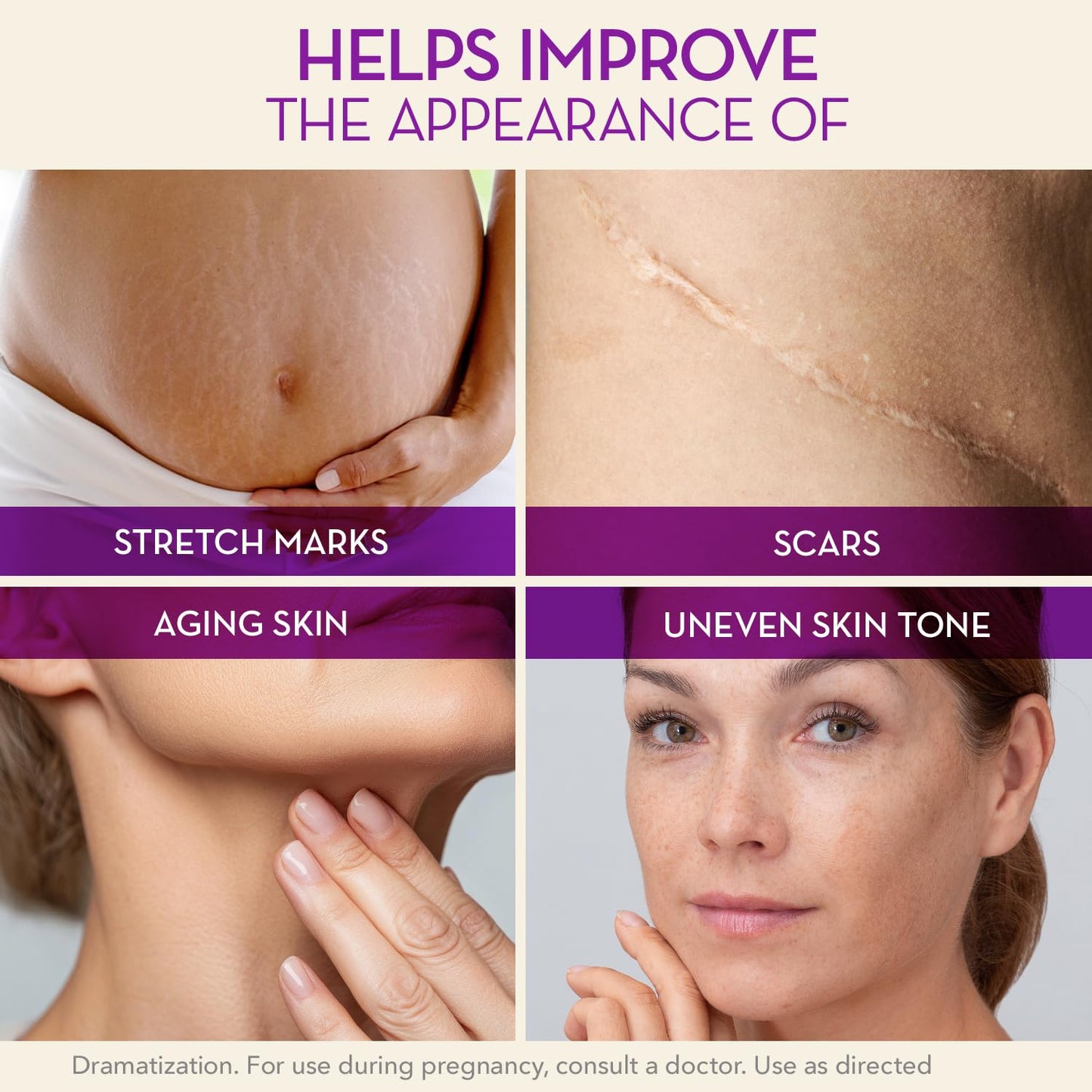 Cicatricure Cica Oil for Stretch Marks & Scars, Visible Results in 4 Weeks, Pregnancy Must-Haves Body Oil with Vitamin E, Stretch Mark Oil, Scar Treatment with Botanical Ingredients, 6.7 fl oz -3 Pack