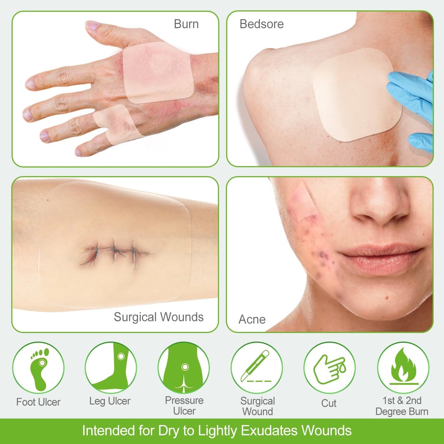 20 Pack Hydrocolloid Wound Dressing 4x4 Inch Extra Thin Hydrocolloid Bandages Patches for Light Exudates Pressure Ulcers, Bed Sores, Minor Burns, Cuts & Abrasions, Blister & Surgical Wound Care