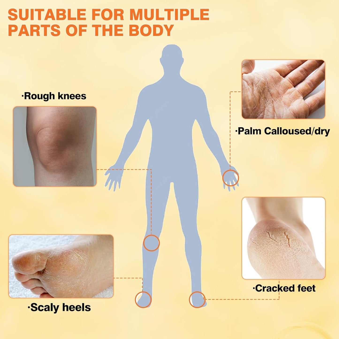 Turmeric & Vitamin C Foot Cream for Dry Cracked Heels and Feet, Ultra-Hydrating Softening Foot Cream, Moisturizes for Healthy Feet, 2.5 oz