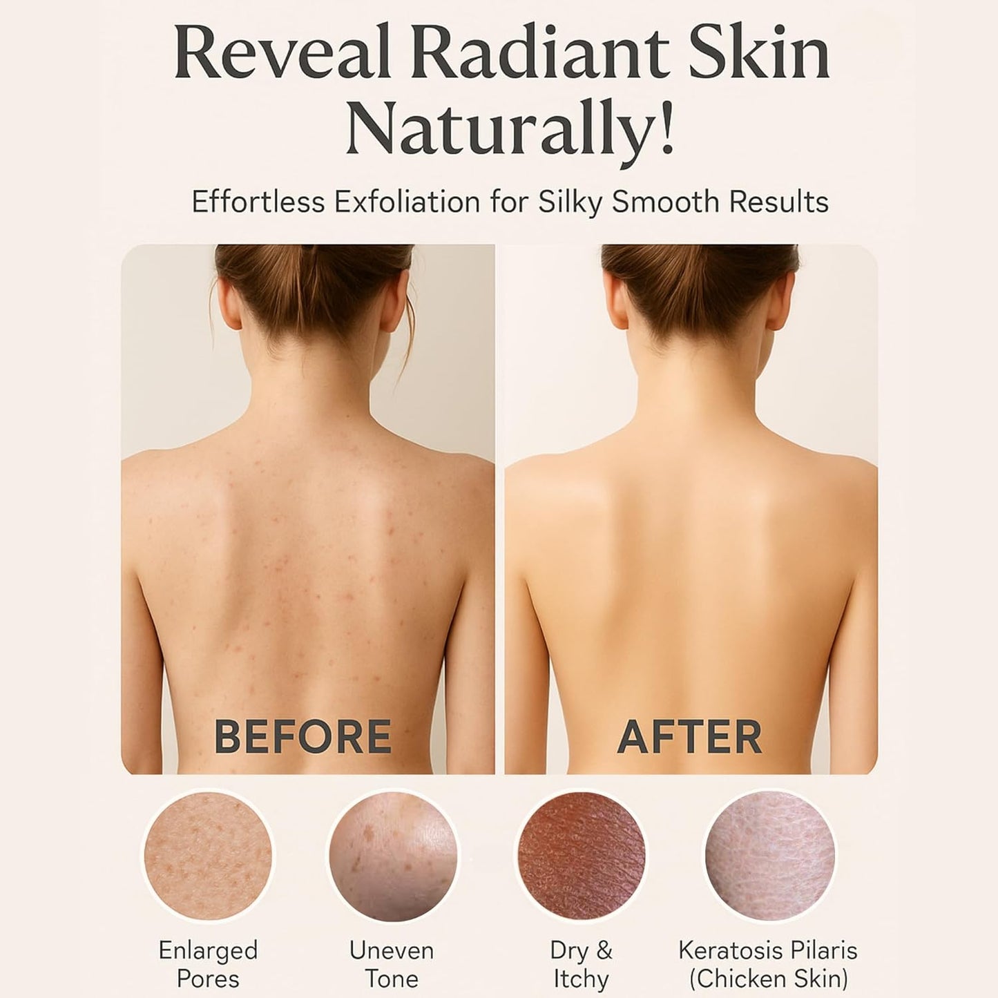 Original Moroccan Kessa Exfoliating Glove Set (ILZO’S) – 3-Piece Hammam Mitts for Face, Body & Back – Deep Skin Cleansing & Dead Skin Removal – Reusable Natural Exfoliator – Assorted Colors (GREEN)