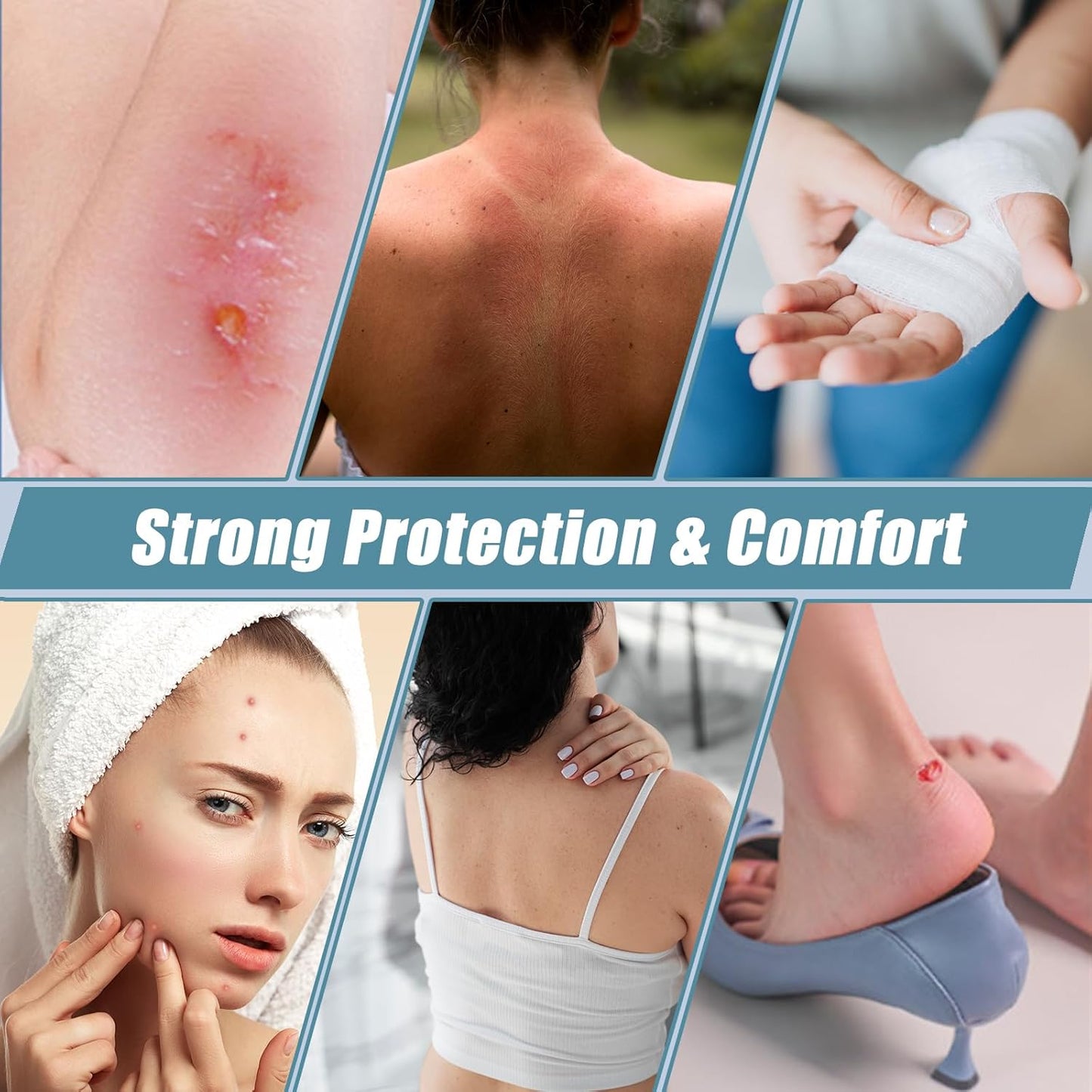 Hydrocolloid Roll for Wound Care - Self-Adhesive Hydrocolloid Bandage 2" x 16.4ft (5cm x 5m), Cut-to-Size, Waterproof, Ultra Absorbent for Blisters, Burns, Acne & Bed Sores