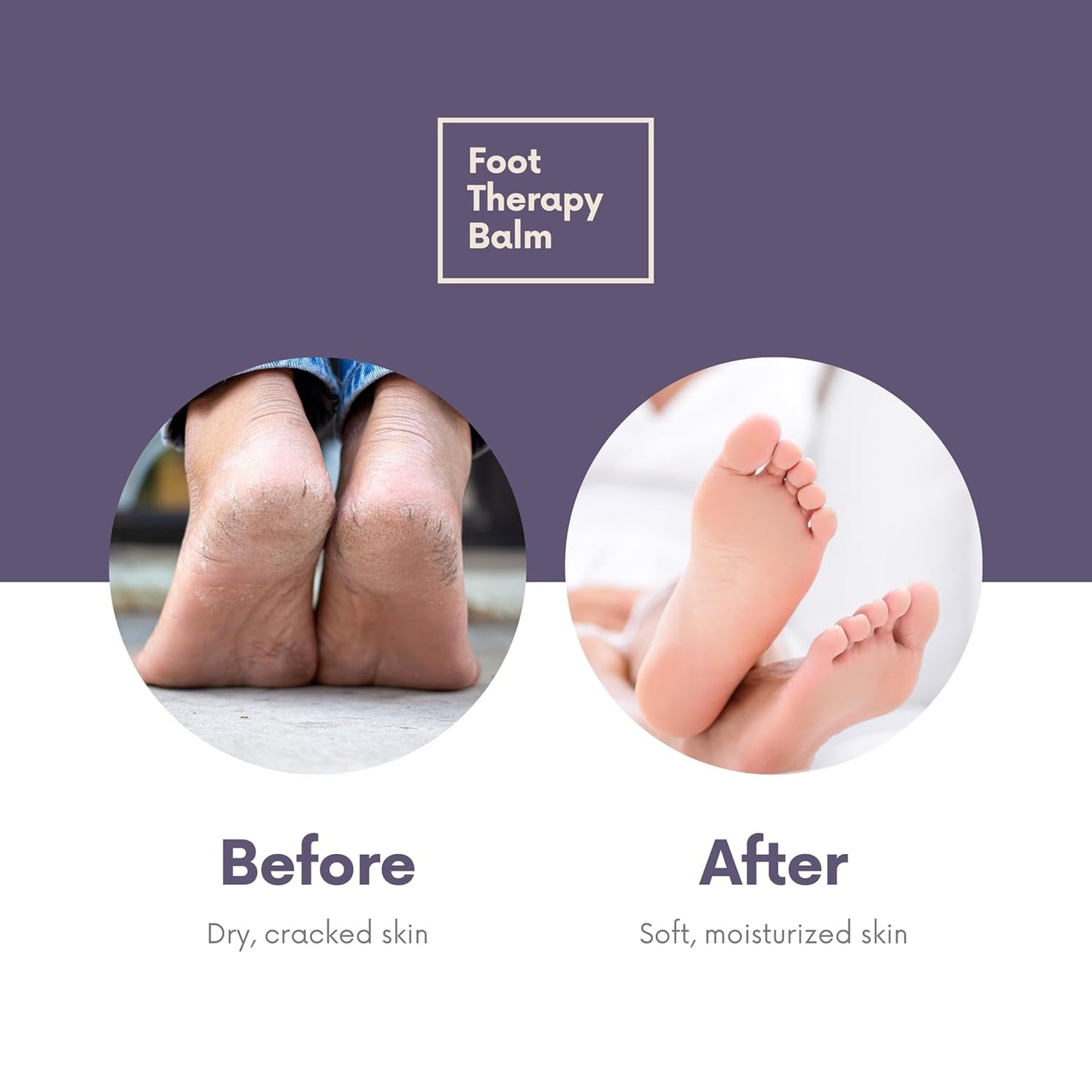 Victoria's Lavender Ultra Rich Foot Balm for Dry Cracked Feet - Heel Repair, Foot Softener Moisturizer with Lavender & Tea Tree Oil, Dry Feet Treatment & Care for Men & Women - Made in the USA - 2.5oz