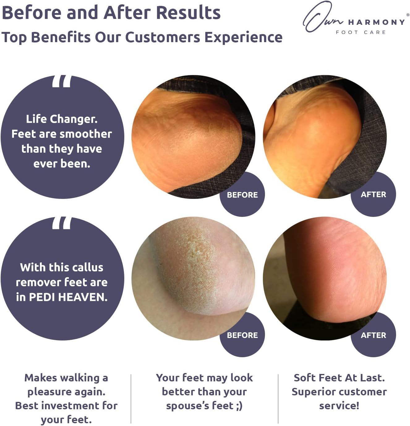 Electric Foot Callus Remover: Own Harmony Professional Feet Care Pedicure Tools, Rechargeable Feet Scrubber Dead Skin, Electronic Foot File Pedi Grinder, Best for Hard, Dry, Cracked Heels (3 Rollers)