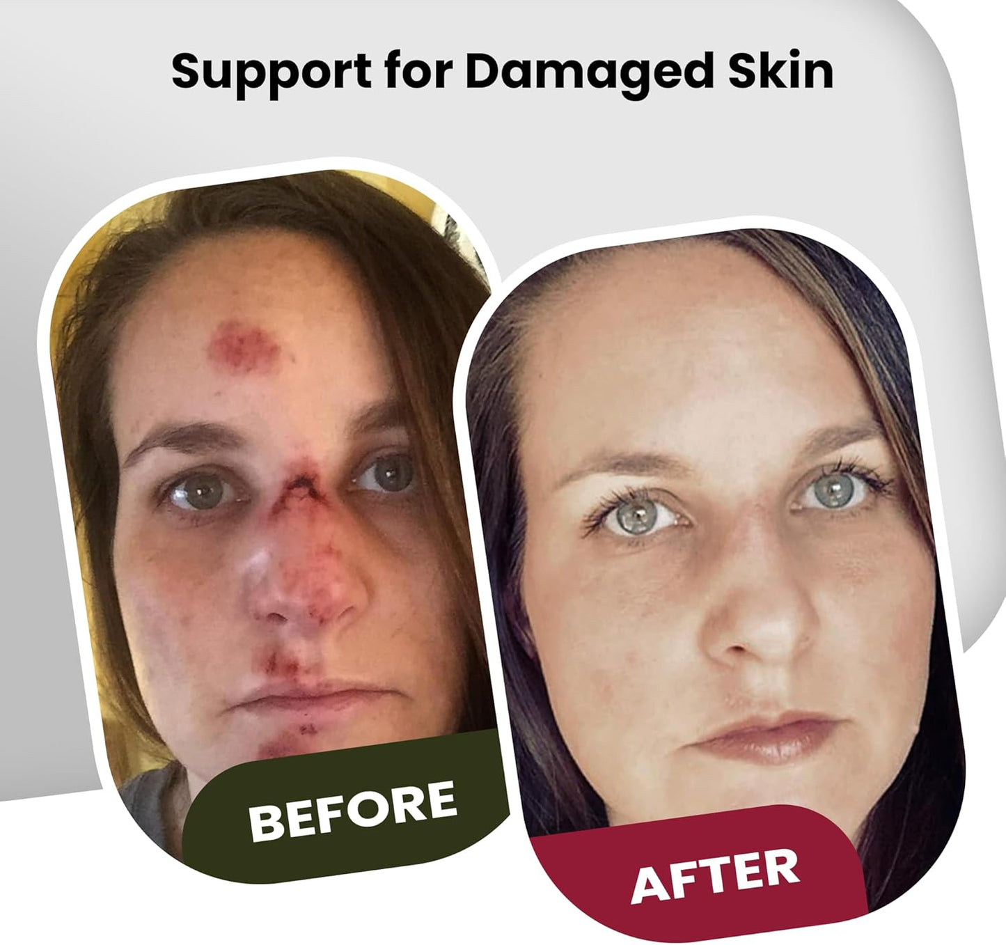 Brave Soldier Antiseptic Healing Ointment - Best Wound Care & Skin Repair Cream with Tea Tree Oil - First Aid Supplies for Burns, Wounds & More, 1 Ounce