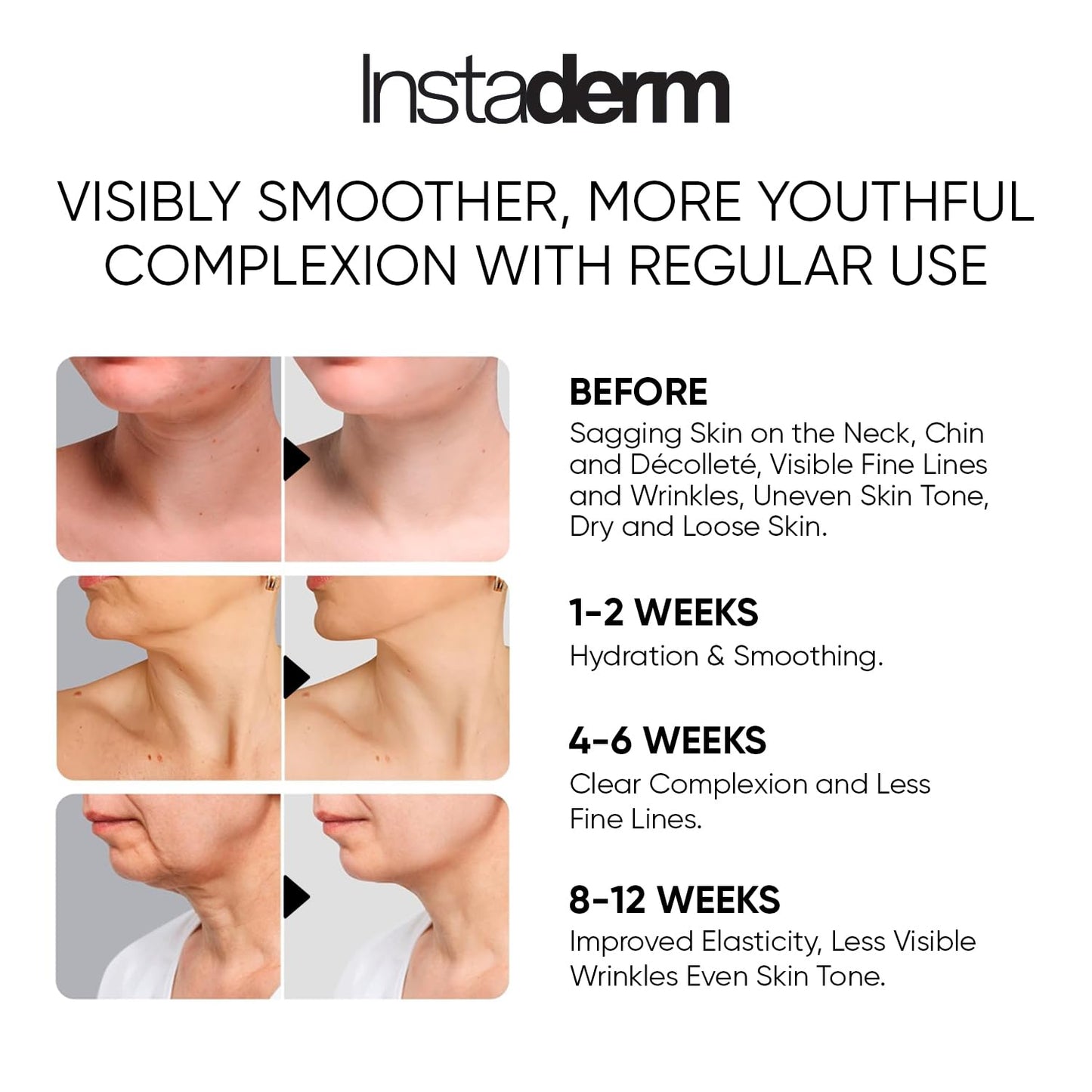 Neck and Décolleté Firming Cream – Tightening & Lifting Treatment for Crepey, Wrinkles, sagging Skin & Vertical Lines. Anti-Aging Peptide Formula to Boost Hydration & Collagen in the Skin.