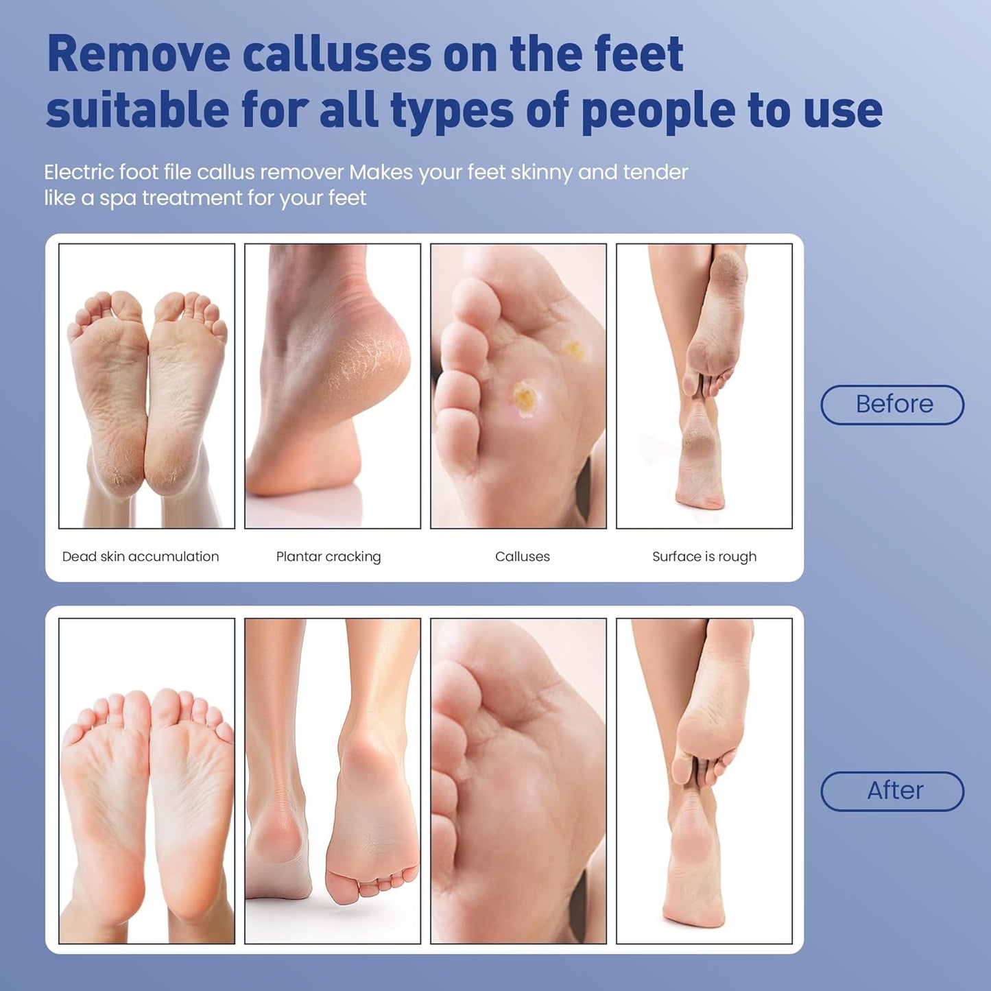 Electric Foot Callus Remover,2 in1 Rechargeable Callus Remover for Feet,9-Speed Cordless Electric Foot File Nail Grinder,Foot Scrubber Pedicure Tools for Dead Skin Dry Cracked Feet (Black Fold)