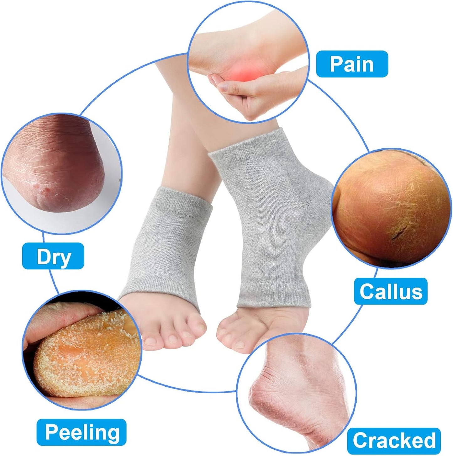 Vented Moisturizing Gel Heel Socks, 3 Pairs Toeless Spa Sock for Foot Care Treatment, Cracked Heels, Dry Feet, Foot Calluses (Black)