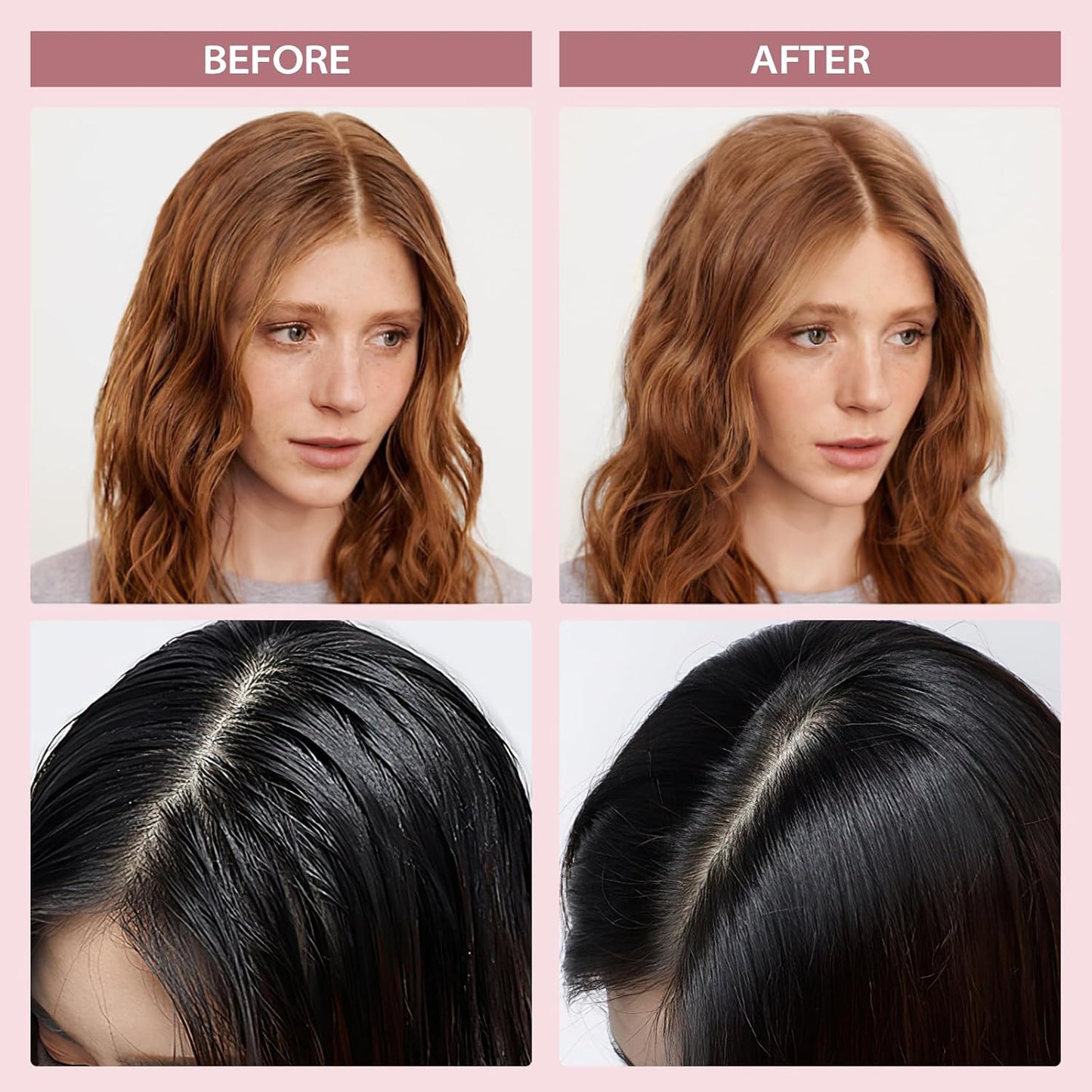 YLNALO Dry Shampoo Powder 2 Packs, Mattifying Root Fuller Looking Refreshing Hair,Non-aerosol, No White Cast, Travel Size Dry Shampoo Suitable for Women and Men,0.58Oz